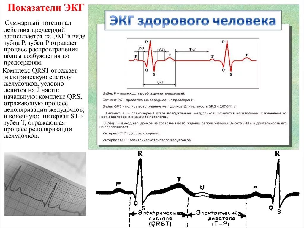 Нарастание зубца. ЭКГ зубец р в норме и при патологии. Нормальные показатели при ЭКГ сердца. Кардиограмма ЭКГ здорового человека с расшифровкой. Электрическая систола желудочков показатели ЭКГ.