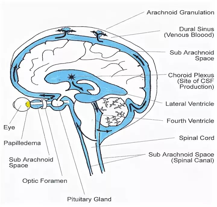 Периневральное пространство зрительного нерва. Субарахноидальное пространство схема. Ликворная система мозга схема. Расширение ликворных пространств.