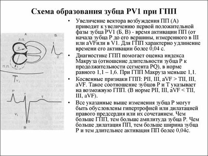 Экг отделы сердца