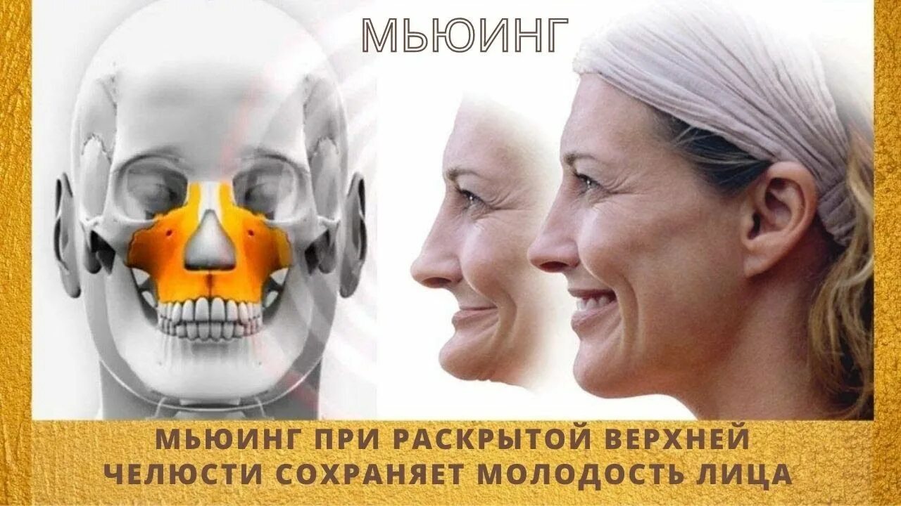 Упражнение маккензи мьюинг. Максилла мьюинг. Смайл мьюинга. Смайл мьюинга. Что такое мьюинг для лица.