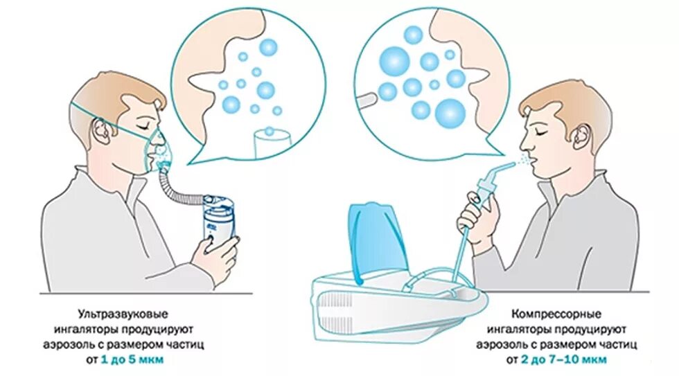Сколько минут ингаляция взрослый. Ингалятор. Ультразвуковые ингаляции. Проведение ингаляции небулайзером. Как правельно двшать небулайзер.