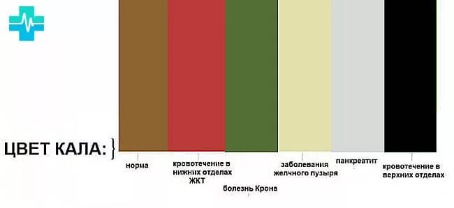Цвет кала. Нормальный цвет кала у здорового человека. Цвет кала у взрослого человека. Каял цвет. Обязывающий цвет