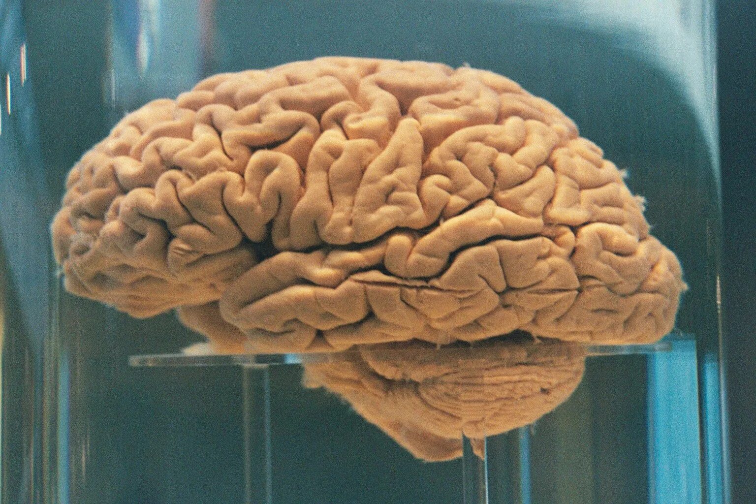 Последний мозг. Головной мозг настоящий.