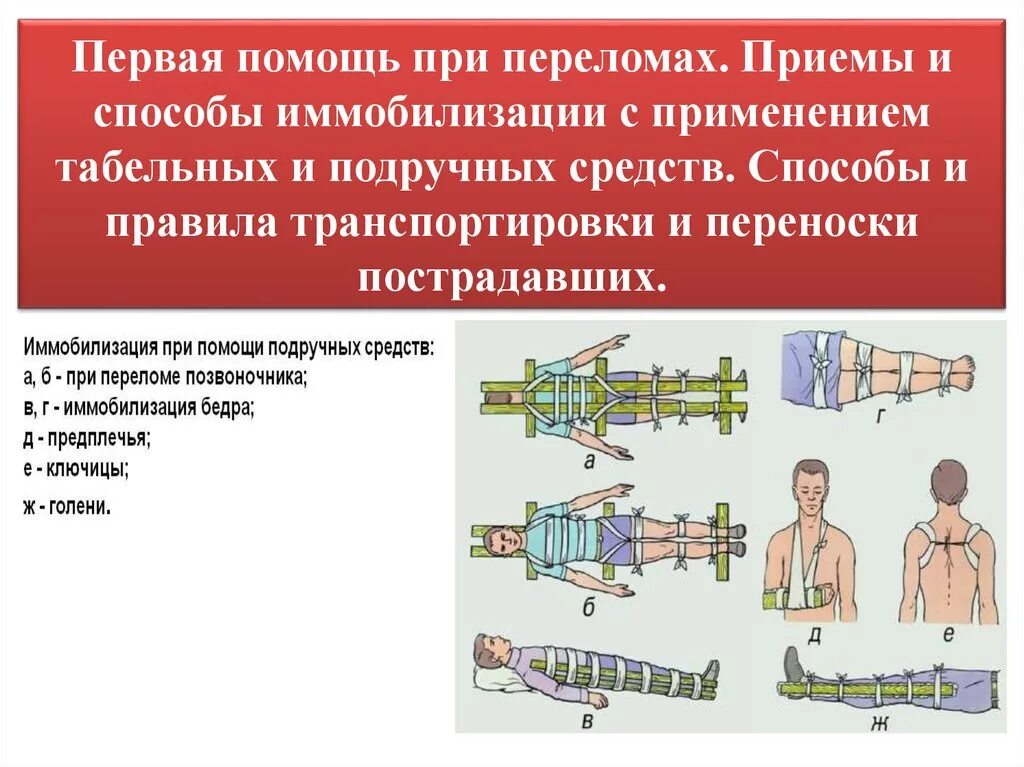 Д3 при переломах. Основное правило иммобилизации при переломах костей конечностей.. Транспортировка пострадавшего иммобилизация конечности. Транспортная иммобилизация конечностей. Способы транспортировки при переломе ноги.