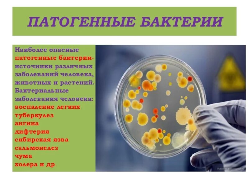 Болезнетворная бактерия 7. Патогенные бактерии. Патогенные микроорганизмы. Презентация на тему бактерии в жизни человека. Условно патогенные бактерии.