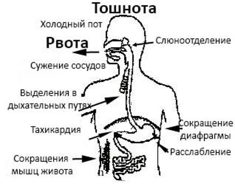 Холодный пот утром. КПК избавится от тышноты. Рвота схема. Как избавитьтсяоо тошноты. Как избавиться от тошноты в домашних.