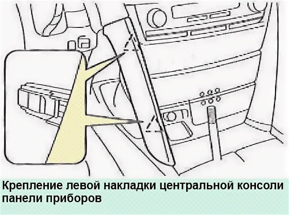 Как снять бороду хендай солярис - 92 фото