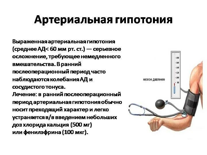 Артериальная гипотензия давление