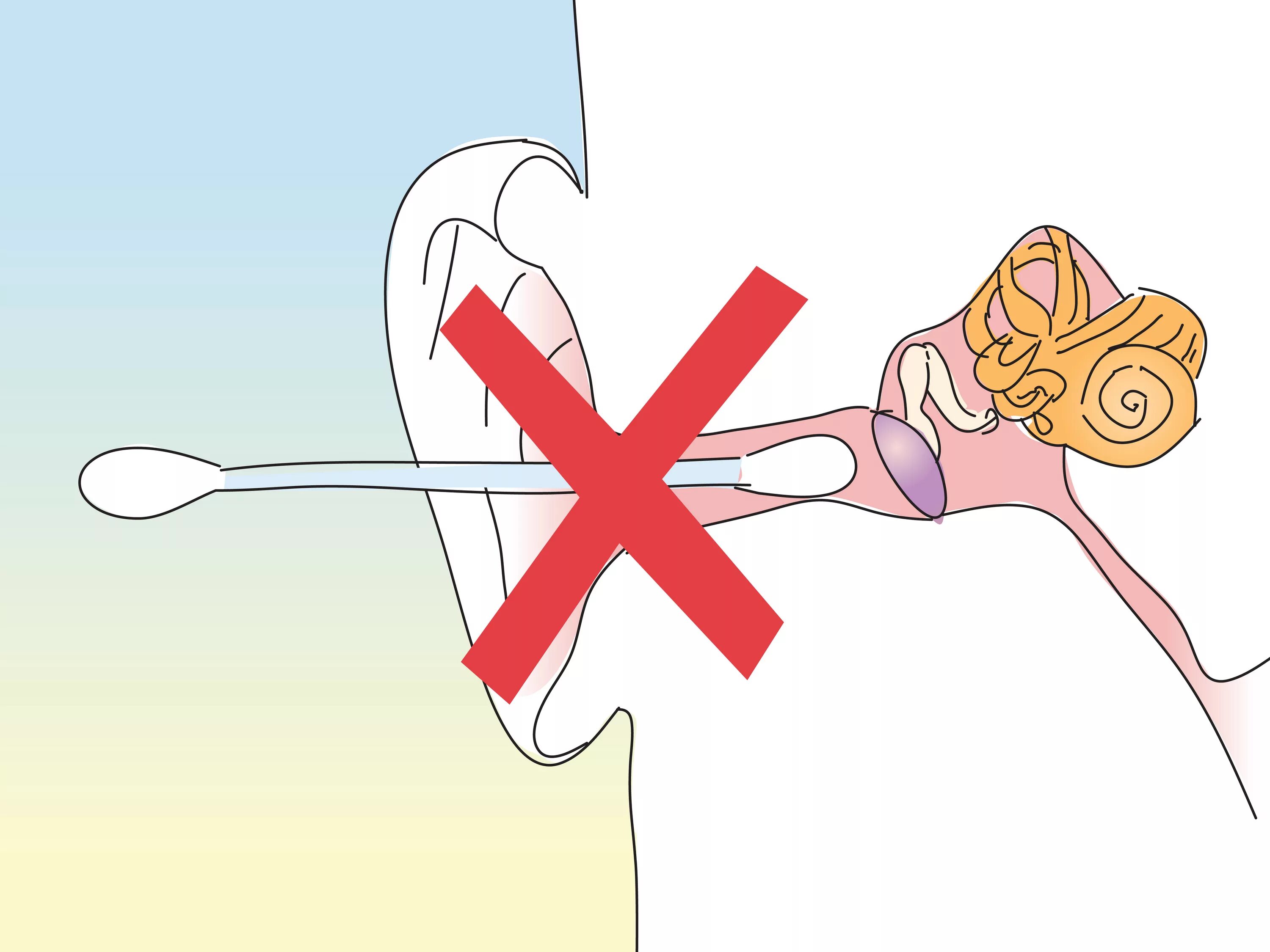 Заложило ухо ватной палочкой что делать. Нельзя чистить уши ватными палочками. Ушные палочки для чистки ушей. Чистка ушей ватными палочками. Правильная гигиена ушей.