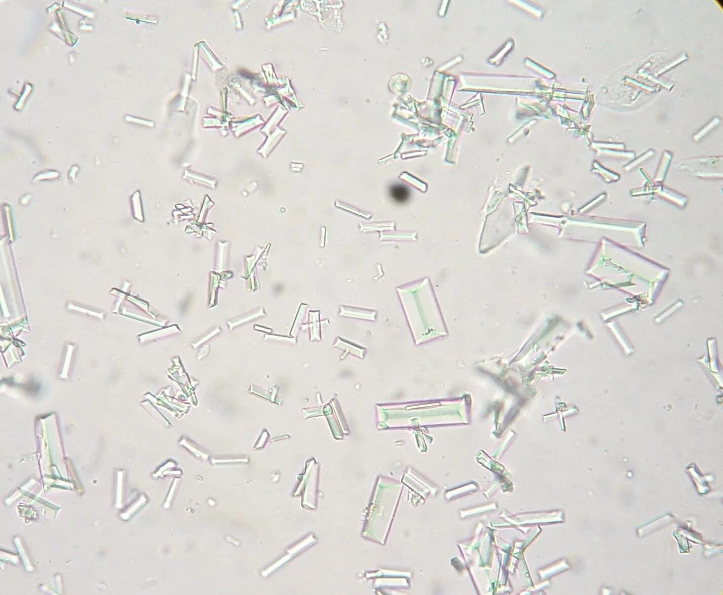 Иглы в моче. Струвиты микроскопия. Струвиты и оксалаты под микроскопом. Струвиты оксалаты трипельфосфаты. Кристаллы трипельфосфаты.