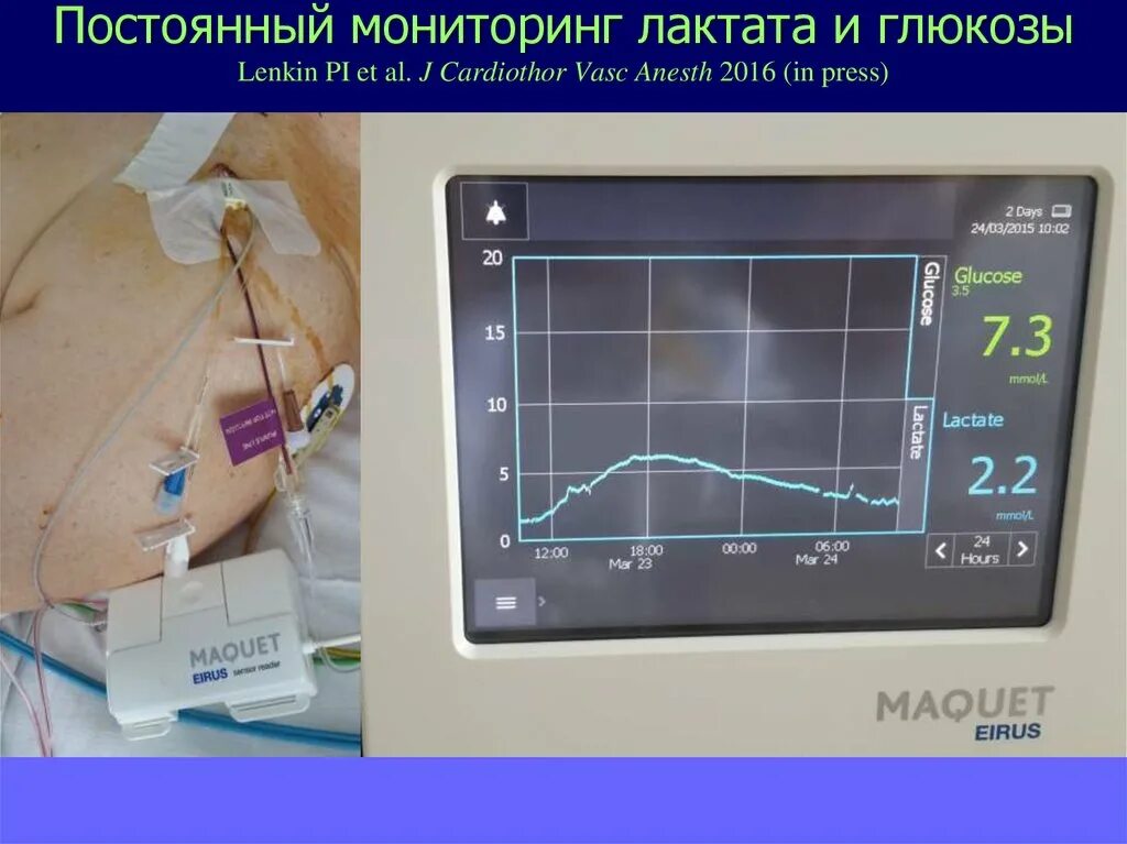 Постоянный непрерывный контроль. Непрерывное мониторирование Глюкозы. Непрерывный мониторинг Глюкозы. Непрерывный мониторинг сахара. Постоянный мониторинг Глюкозы.