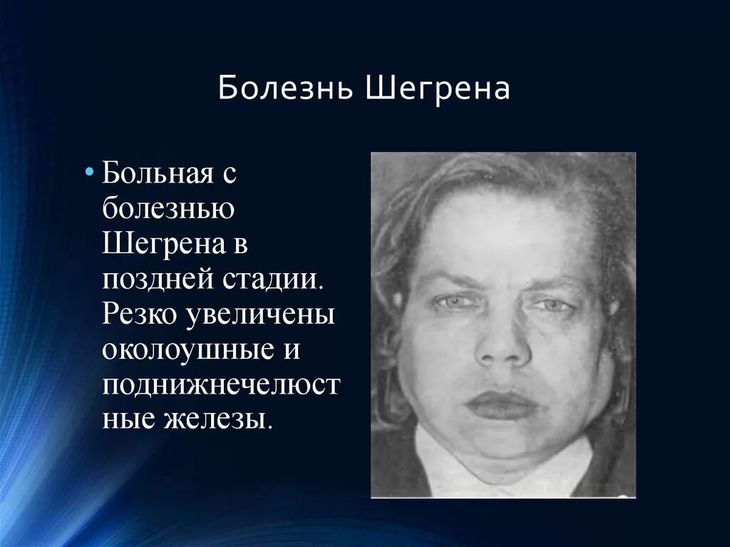 Болезнь это нарушение нормальной жизнедеятельности. Клинические проявления болезни аддисона. Болезнь это определение. Legionella pneumophila заболевания. Заболевание disease.