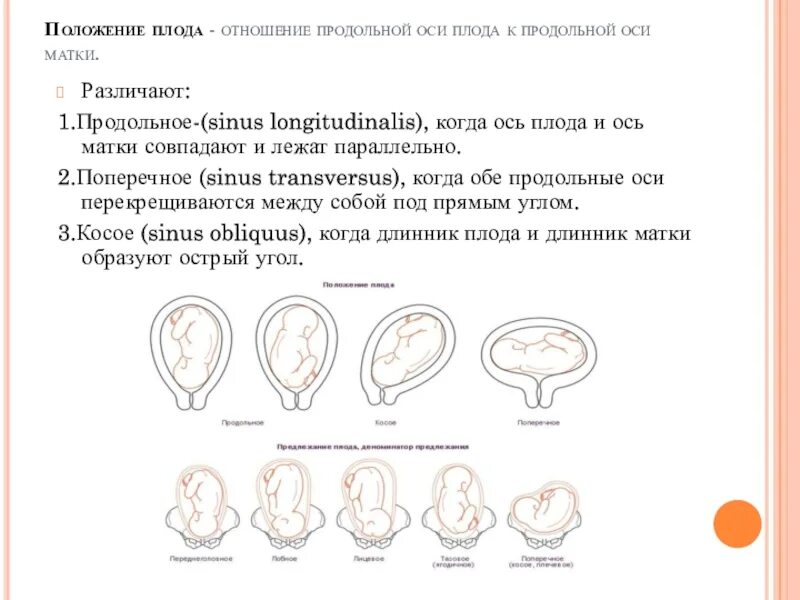 Что означает предлежание. Первая позиция продольное положение тазовое предлежание. Позиция и вид при поперечном положении плода. Позиция плода при продольном положении. Продольная ось плода и матки.