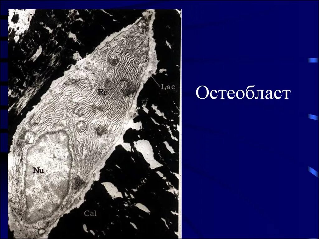 Остеобласт органеллы. Остеобласты гистология. Пластинчатая костная ткань остеобласты. Остеобласты. Остеобласты и остеокласты.