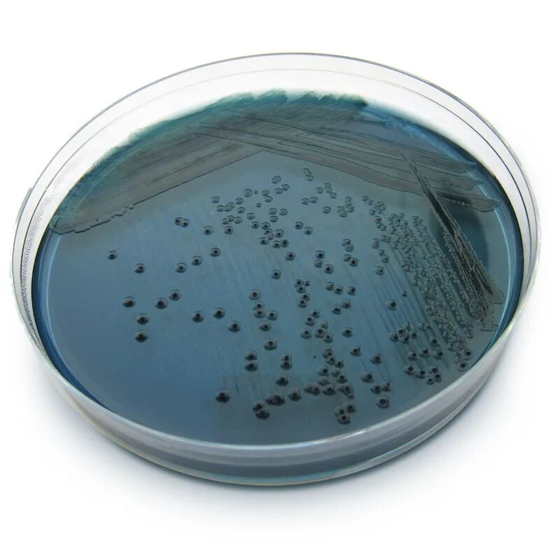 Spp salmonella spp shigella spp