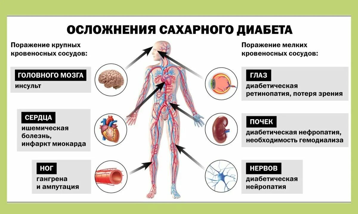 Осложнения СД 1 типа. Профилактика осложнений сахарного диабета. Хронические осложнения СД. Осложнения СД 1 типа и 2 типа.