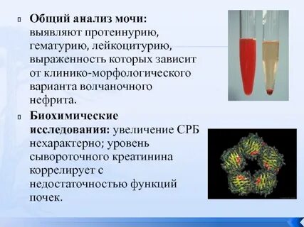 Гематурия общий анализ мочи