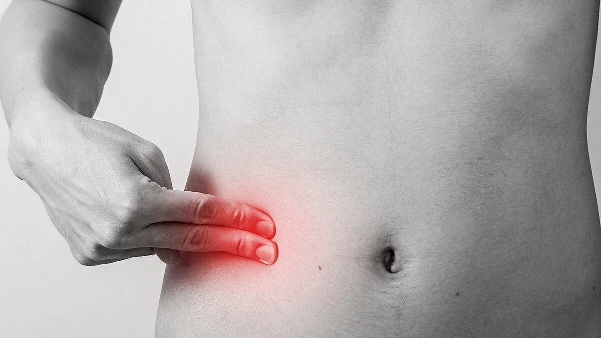 Аппендицит бок. Аппендицит воспаление кишечника. Расположение аппендикса у человека. Человек держится за живот. Где находится аппендицит.