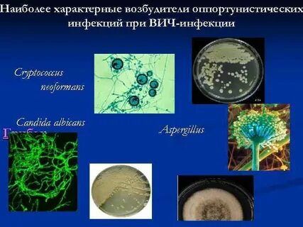 Возбудители оппортунистических инфекций