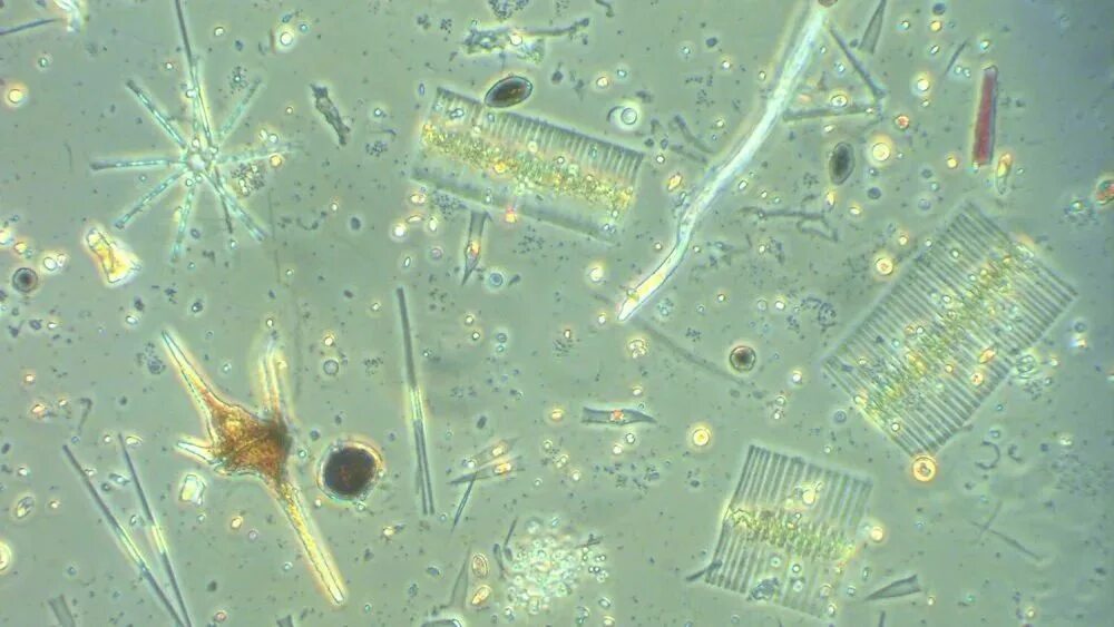 Микроводоросли под микроскопом. Водоросли и их названия. Динофлагелляты под микроскопом. Первые водоросли на земле.