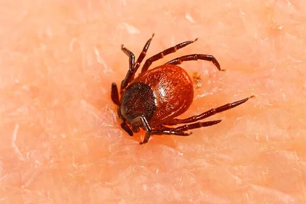 Ticks will be worse than normal this year in Massachusetts, here's how to protec