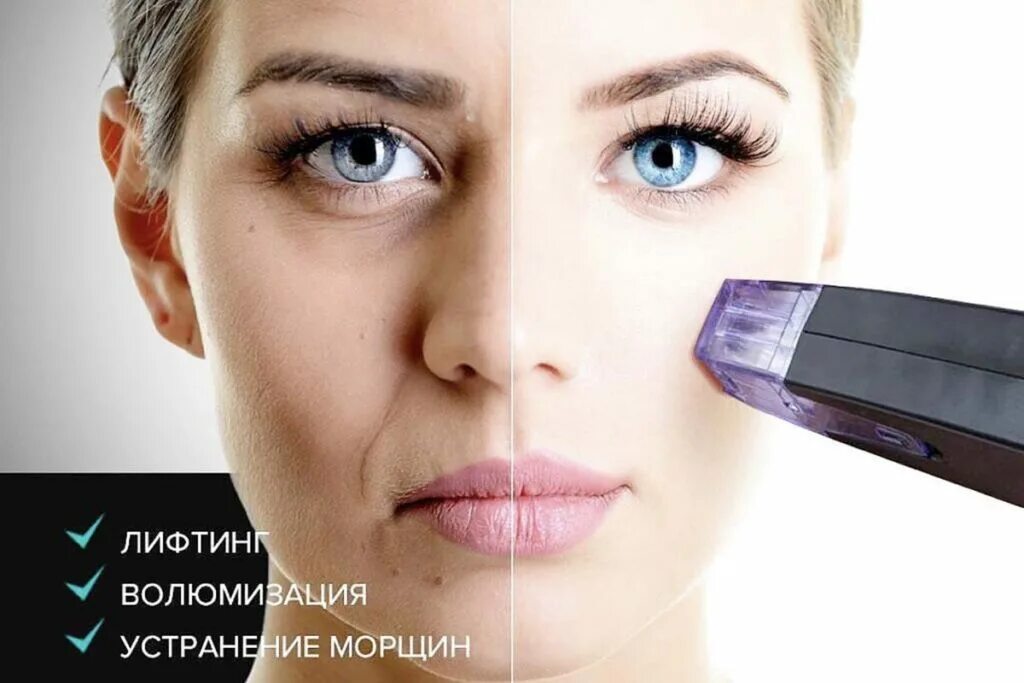 Морфеус косметология отзывы. Морфеус косметология отзывы. Морфеус косметология отзывы. Морфеус косметология отзывы. Игольчатый лифтинг morpheus 8.