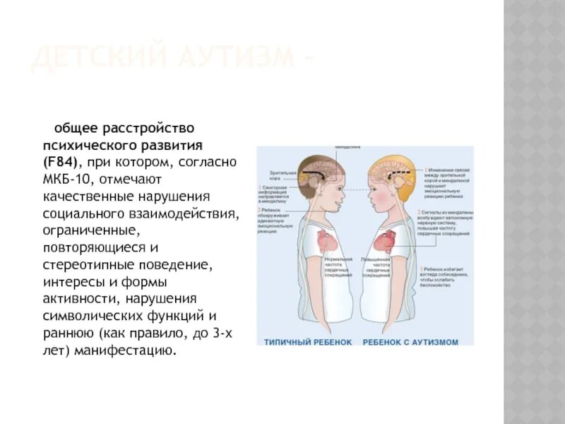 5 общих нарушений развития. Общие расстройства развития. стереотипный зажим плечами у аутистов. общее расстройство развития (f 84.0). мкб аутизм.