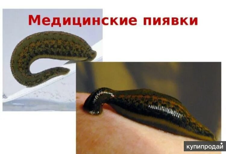 Пиявки кольчатые черви. Описание кольчатых червей 7 класс биология. Представитель типа кольчатые черви пиявка. Пиявка относится к моллюскам. Медицинская пиявка гирудотерапия.
