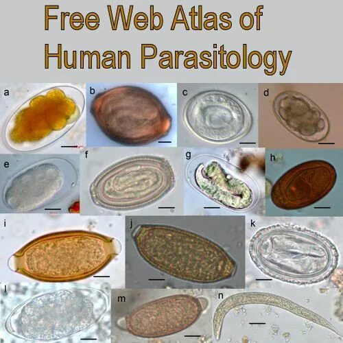 Mix egg parasite human stock image. Image of schistosomiasis - 68730671