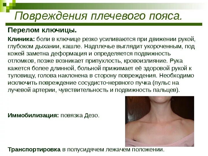 Боли отдающие в правую ключицу. Болит в области ключицы слева спереди. Болезненность ключицы. Перелом ключицы со смещением у ребенка 11 лет. Стенокардия иррадиация болей.