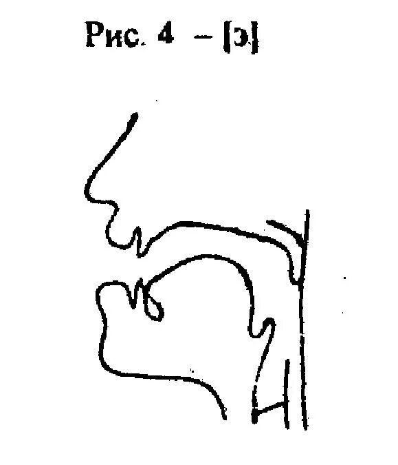 Произношение звука э. Артикуляционные профили гласных звуков. Артикуляционный уклад звука э. Артикуляционные профили гласных звуков при ринолалии. Артикуляционный профиль гласныхзвуов.