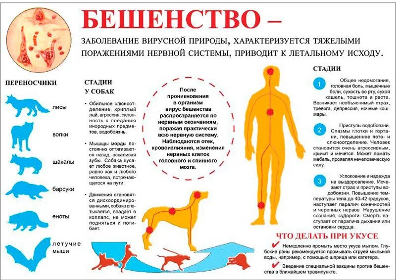 Симптомы проявления бешенства у человека. Периоды развития болезней бешенство. Клинические симптомы бешенства. Профилактика бешенства.. Клинический симптом бешенства человека. Какие заболевания заразные