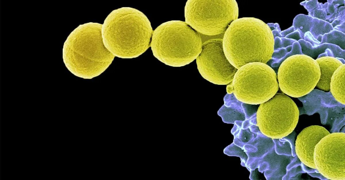 2 staphylococcus aureus