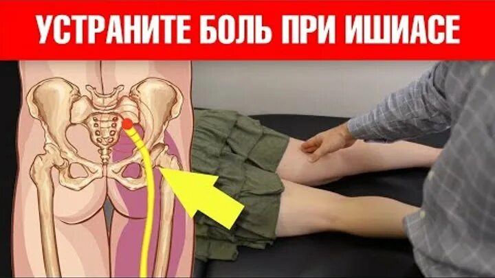 Седалищный нерв как снять боль быстро Разблокировка седалищного нерва. Техника. Седалищный нервты босату жаттығуы. Y