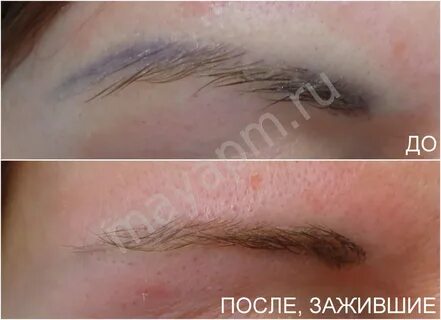 После татуажа мазать