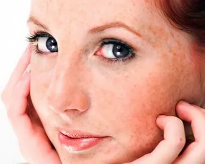 Sensitive skin