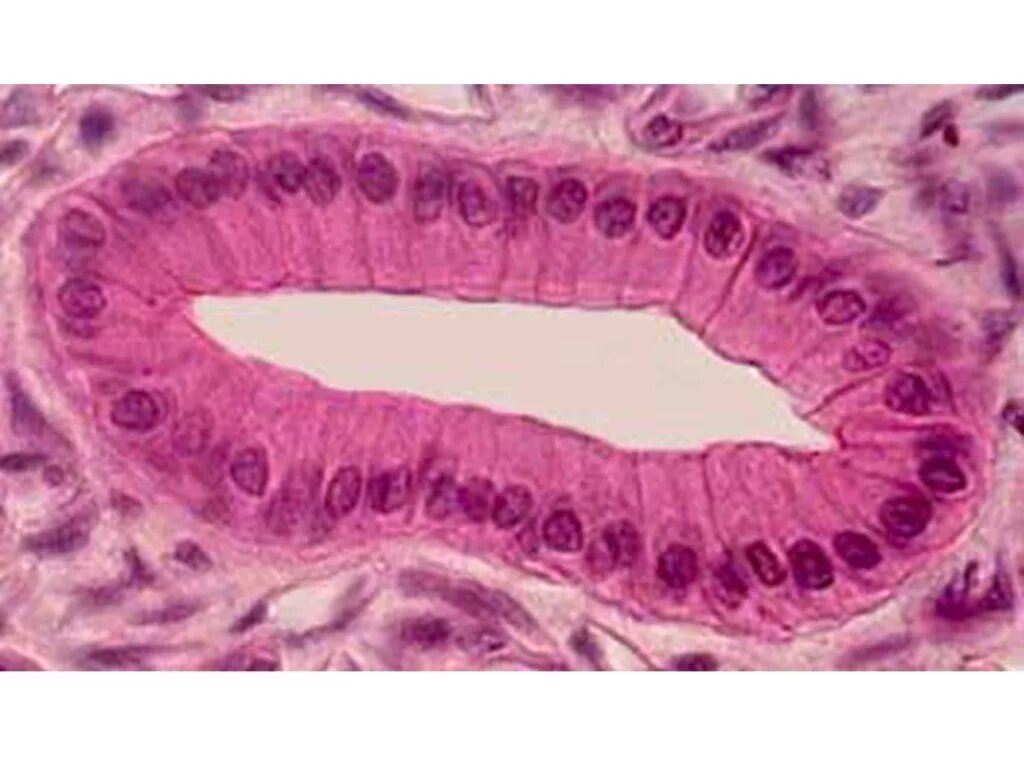 Cellule Della Mucosa Orale Umanazellen Der Mundschleimhaut - Fotografie stock e 