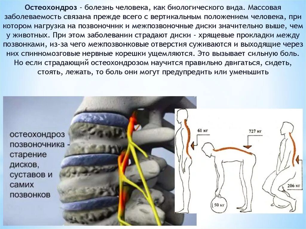 Давление в пояснице. Остеохондроз. Остеохондроз позвоночника. Нагрузка на позвоночник. Заболевания позвоночника остеохондроз.