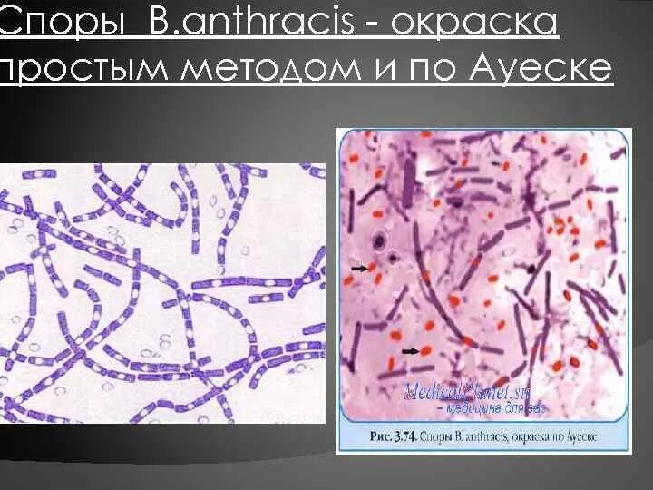 Окраска спор бактерий. Окраска спор методом Ожешко. Bacillus Cereus по методу Ожешко. Метод Ожешко бациллы. Сибирская язва окраска по Ожешко.