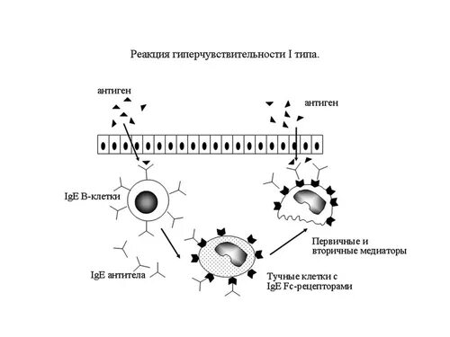 Иммунная гиперчувствительность. Механизмы развития реакций гиперчувствительности. Первый механизм развития реакции гиперчувствительности. Гиперчувствительность немедленного типа (ГНТ схема. Механизм развития гиперчувствительности 1 типа.