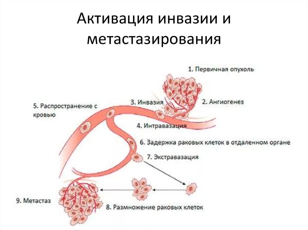 Механизм метастазирования злокачественной опухоли схема. Схема метастазирования опухолевых клеток. Активация инвазии и метастазирования. Схема образование опухоли.