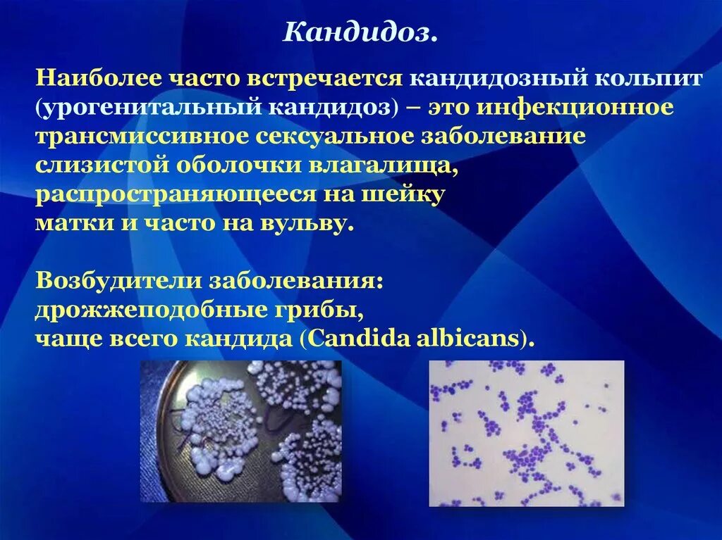 Молочница у женщин передается мужчинам. Инфекционное заболевание кандидоз. Кандидоз возбудитель инфекции. Кандидоз этиология.