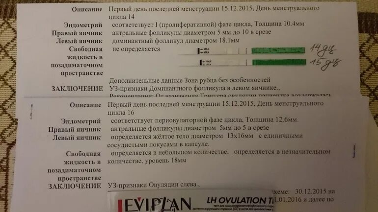 Сколько должен быть эндометрия для зачатия. Желтое тело по дням цикла. Размер желтого тела после овуляции. Желтое тело на 20 день цикла. Желтое тело на 12 день цикла.