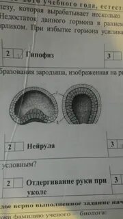 На рисунке изображен эмбрион