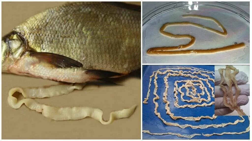 Лямблии аскариды описторхи