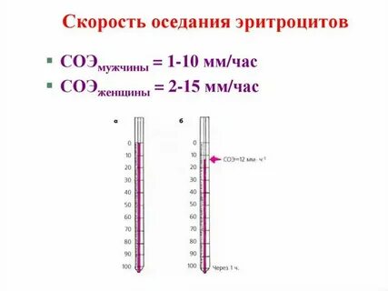 Л с ч что это