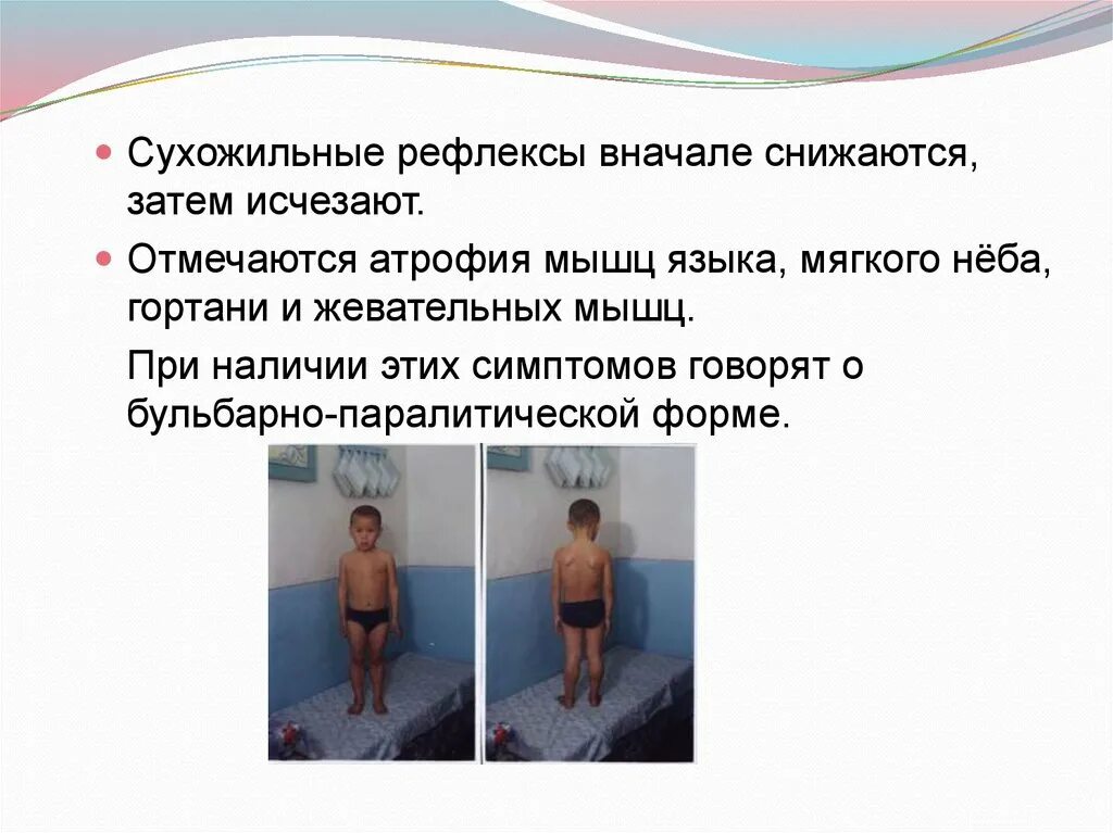Собака атрофия мышц. Атрофия мышц это основной симптом.