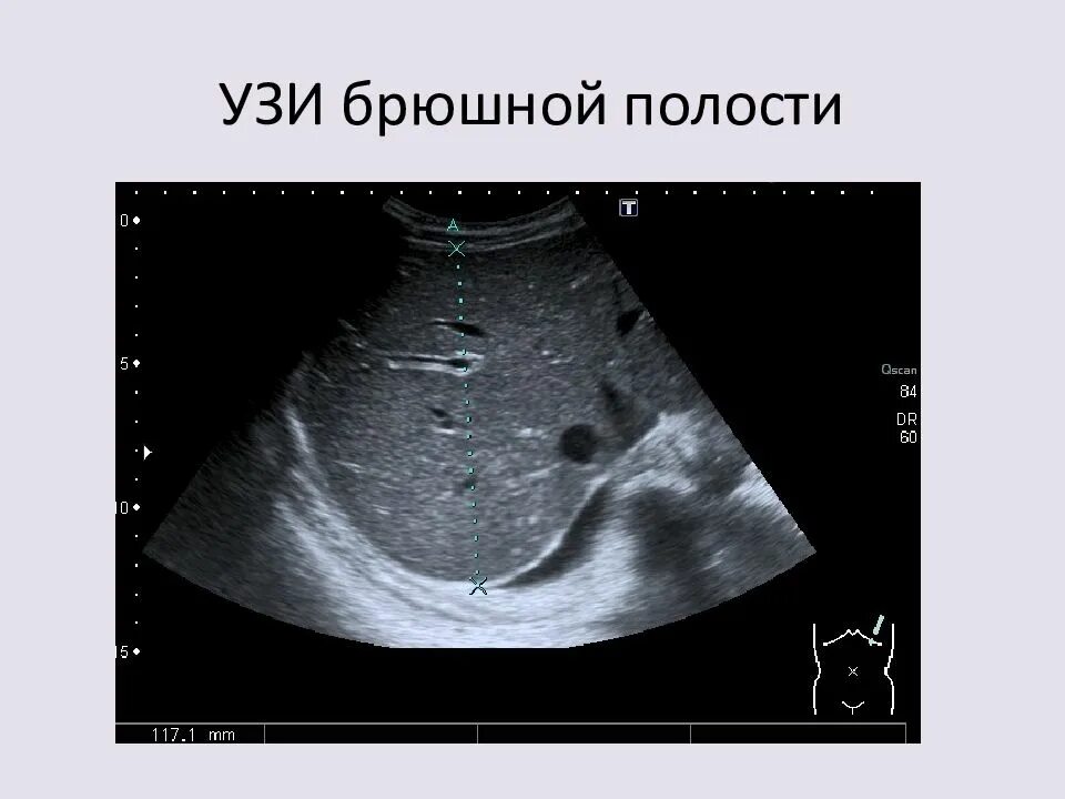 Ультразвуковое исследование органов брюшной полости. УЗИ брюшной. УЗИ брюшной полости снимок. УЗИ брюшной полости картинки. Узи органов брюшной полости подготовка у женщин