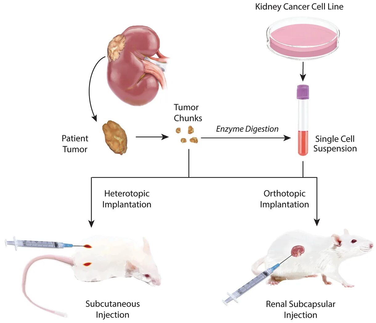 Дифференцировка нейробластов и глиобластов. Patient derived. Patient derived xenograft перевод. Ips клетки. Patient derived.