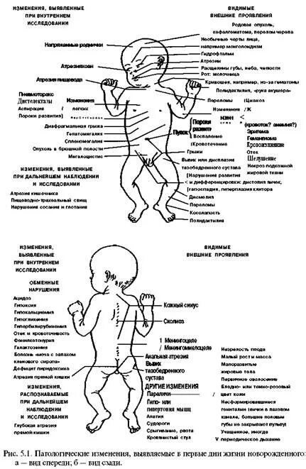 Физиология новорожденных
